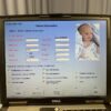 Natus Newborn Hearing Screener – ALGO 3 – 2005 – Audiometers Auditors System