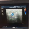 Philips L17-5 Linear Ultrasound Transducer Probe for IU22 IE33 – 2012