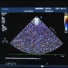 Philips iE33 Diagnostic Cardiovascular Ultrasound Machine – 2006
