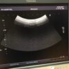 Toshiba PVT-375BT Convex Array Transducer Ultrasound Probe PVT-375 BT – 2014 – Used