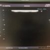 Toshiba PLT-805AT Linear Transducer Ultrasound Probe PLT-805 AT – 2007 – Used