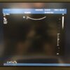 Philips V6-2 Ultrasound Transducer Probe to suit IU22