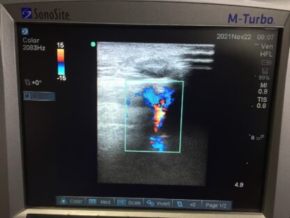 Sonosite HFL38x/13-6 MHz Linear Array Ultrasound Probe – P07682-70