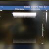 Philips L9-3 Linear Ultrasound Transducer Probe