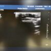 Philips L9-3 Linear Ultrasound Transducer Probe