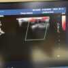 Philips L9-3 Linear Ultrasound Transducer Probe