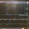 Toshiba  PLT-805AT Linear Array Transducer Ultrasound Probe for APLIO XG #2