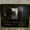 Philips L12-4 Broadband Linear Array Probe Ultrasound Transducer for Sparq