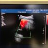 Philips C9-4 Curved Array Ultrasound Transducer Probe – IU22