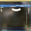 Philips C9-4 Curved Array Ultrasound Transducer Probe – IU22