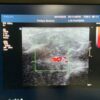 Philips L15-7io Compact Linear Array Ultrasound Transducer Probe – IU22