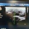 Philips L15-7io Compact Linear Array Ultrasound Transducer Probe – IU22