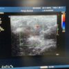 Philips L15-7io Compact Linear Array Ultrasound Transducer Probe – IU22
