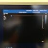 Philips L15-7io Compact Linear Array Ultrasound Transducer Probe – IU22