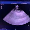 Philips S5-1 Broadband Sector Array Ultrasound Transducer Probe – IU22 – Defects