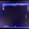 Philips S5-1 Broadband Sector Array Ultrasound Transducer Probe – IU22 – Defects