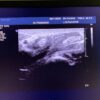 Philips L15-7io Linear Array Hockey Stick Ultrasound Transducer Probe – IU22