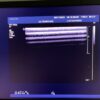 Philips L15-7io Linear Array Hockey Stick Ultrasound Transducer Probe – IU22