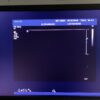 Philips L15-7io Linear Array Hockey Stick Ultrasound Transducer Probe – IU22