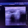 Philips L9-3 Linear Ultrasound Transducer Probe – IU22 #2