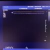 Philips L9-3 Linear Ultrasound Transducer Probe – IU22 #2