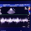 Philips S12-4 Sector Array Ultrasound Transducer Probe