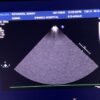 Philips S12-4 Sector Array Ultrasound Transducer Probe