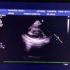 Philips S5-1 Broadband Sector Array Ultrasound Transducer Probe