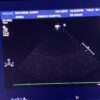 Philips S5-1 Broadband Sector Array Ultrasound Transducer Probe