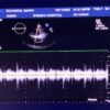 Philips X5-1 xMATRIX Array Ultrasound Transducer Probe w PureWave Crystal Technology