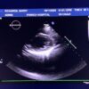 Philips X5-1 xMATRIX Array Ultrasound Transducer Probe w PureWave Crystal Technology