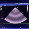 Philips X5-1 xMATRIX Array Ultrasound Transducer Probe w PureWave Crystal Technology