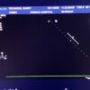 Philips S8-3 Sector Array Ultrasound Transducer Probe