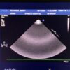 Philips S8-3 Sector Array Ultrasound Transducer Probe