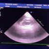 Philips S8-3 Sector Array Ultrasound Transducer Probe