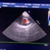 Philips S8-3 Sector Array Ultrasound Transducer Probe