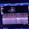 Philips S8-3 Sector Array Ultrasound Transducer Probe
