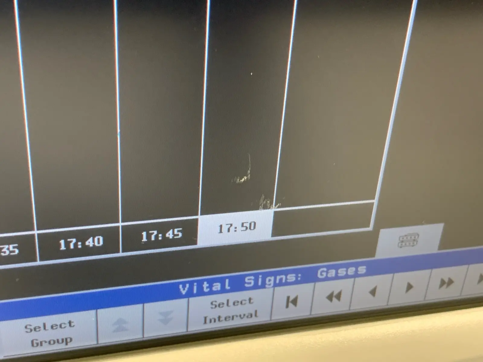 Philips M8001A IntelliVue MP20 Junior Patient Monitor - Image 10