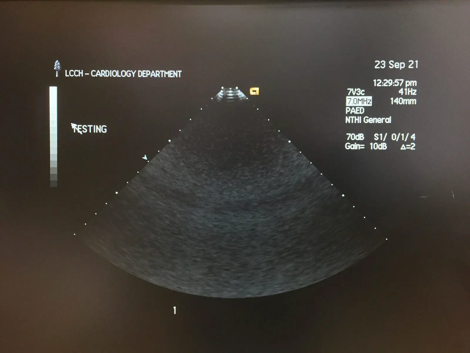 Siemens 7V3c Acuson Ultrasound Probe Transducer