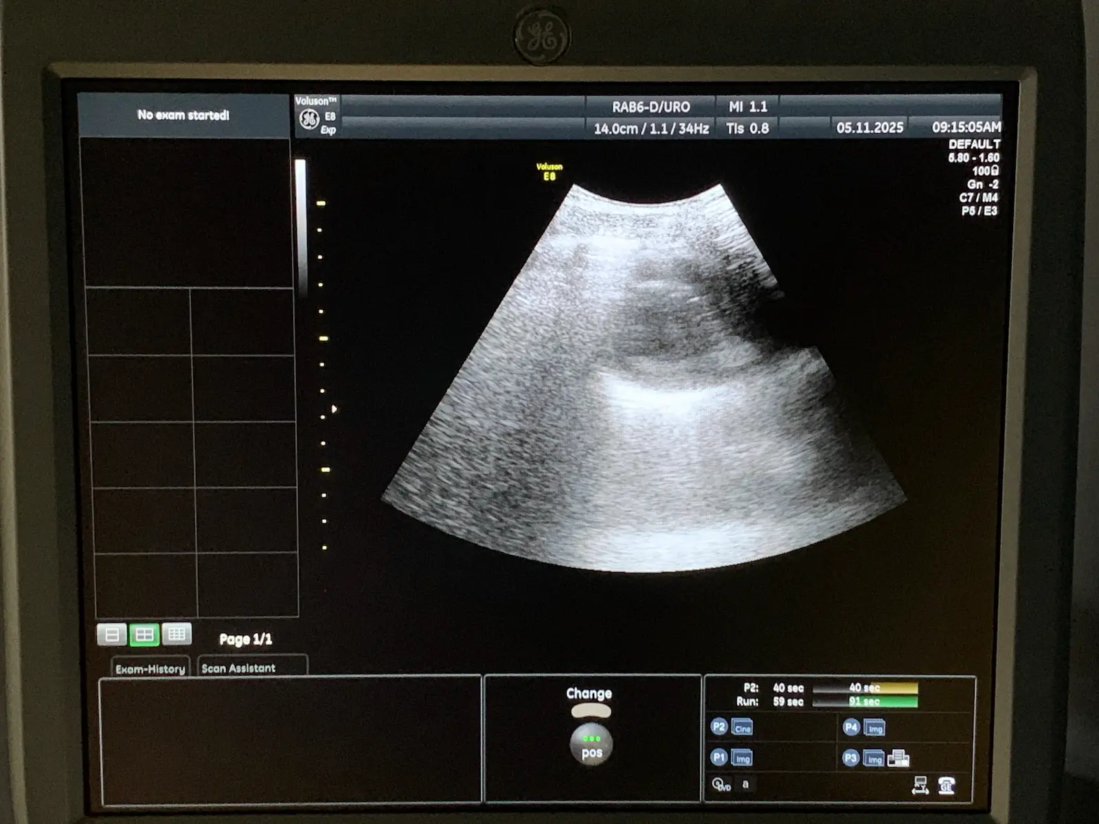 GE Health RAB6-D Broad-Spectrum Real-Time 4D Probe