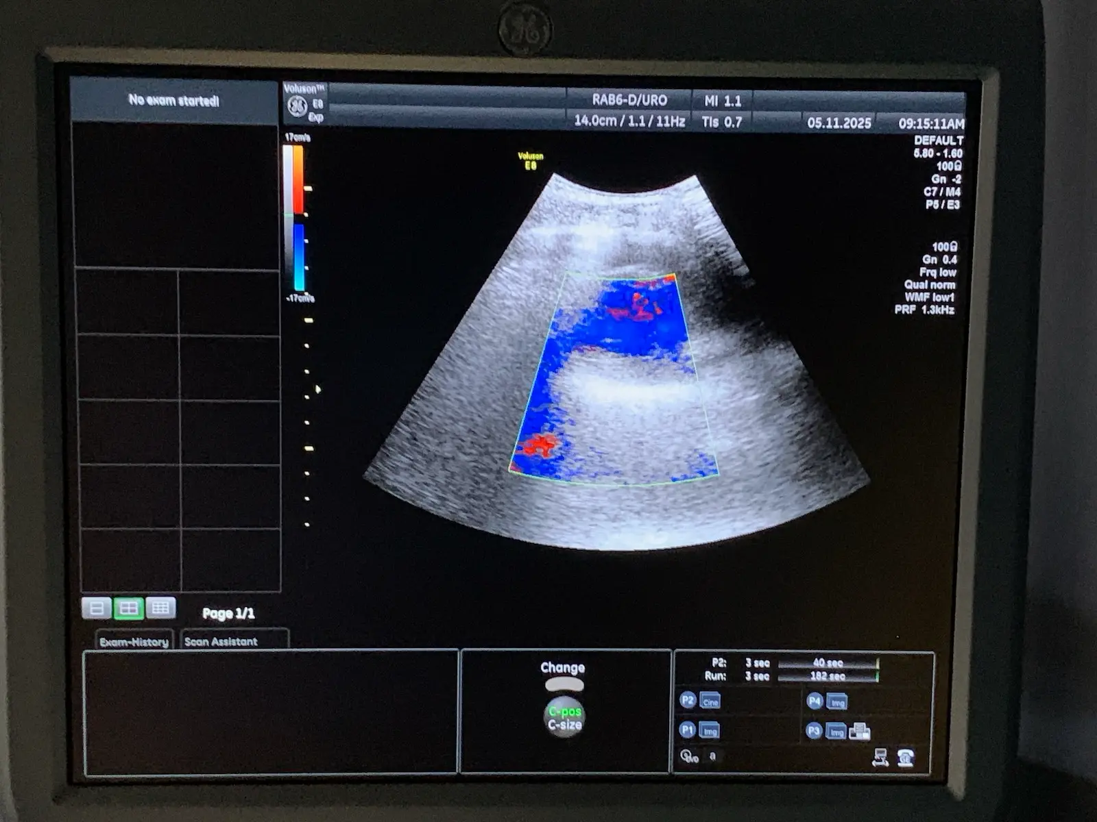 GE Health RAB6-D Broad-Spectrum Real-Time 4D Probe