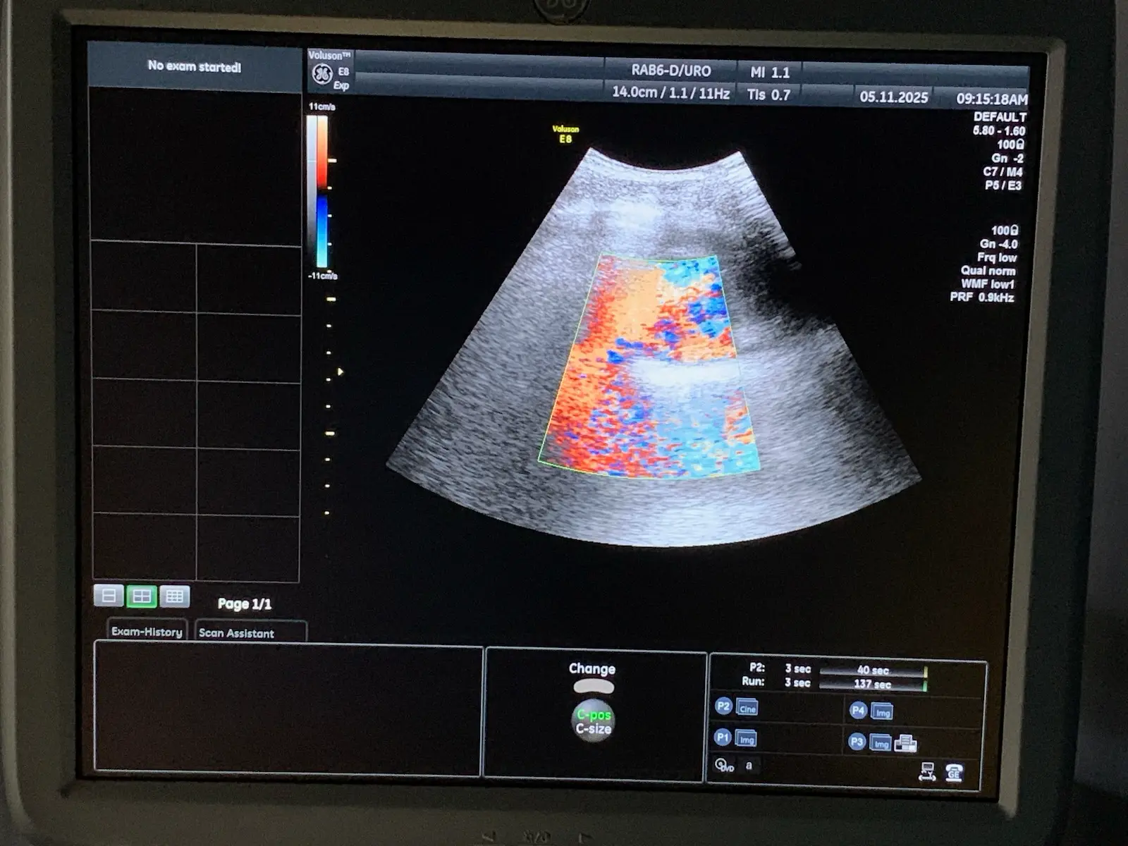 GE Health RAB6-D Broad-Spectrum Real-Time 4D Probe