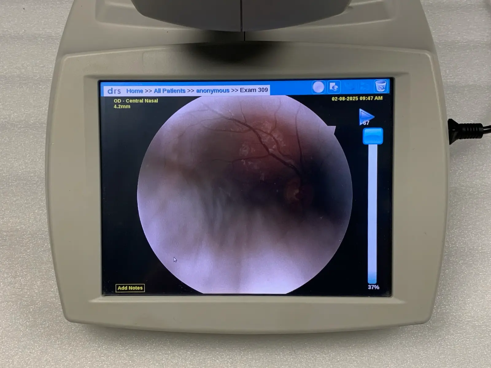 Centervue DRS Digital Retinography System Automatic Retinal Camera