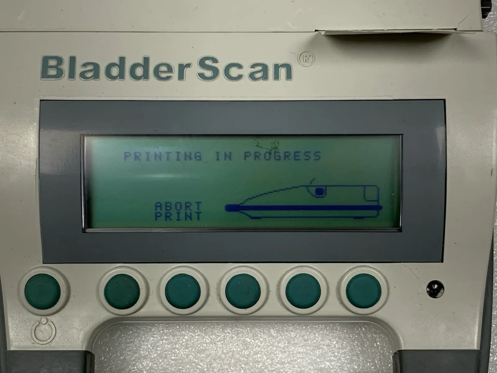 Verathon BladderScan BVI 3000 Portable 3D Ultrasound Scanner - TESTED & WORKING