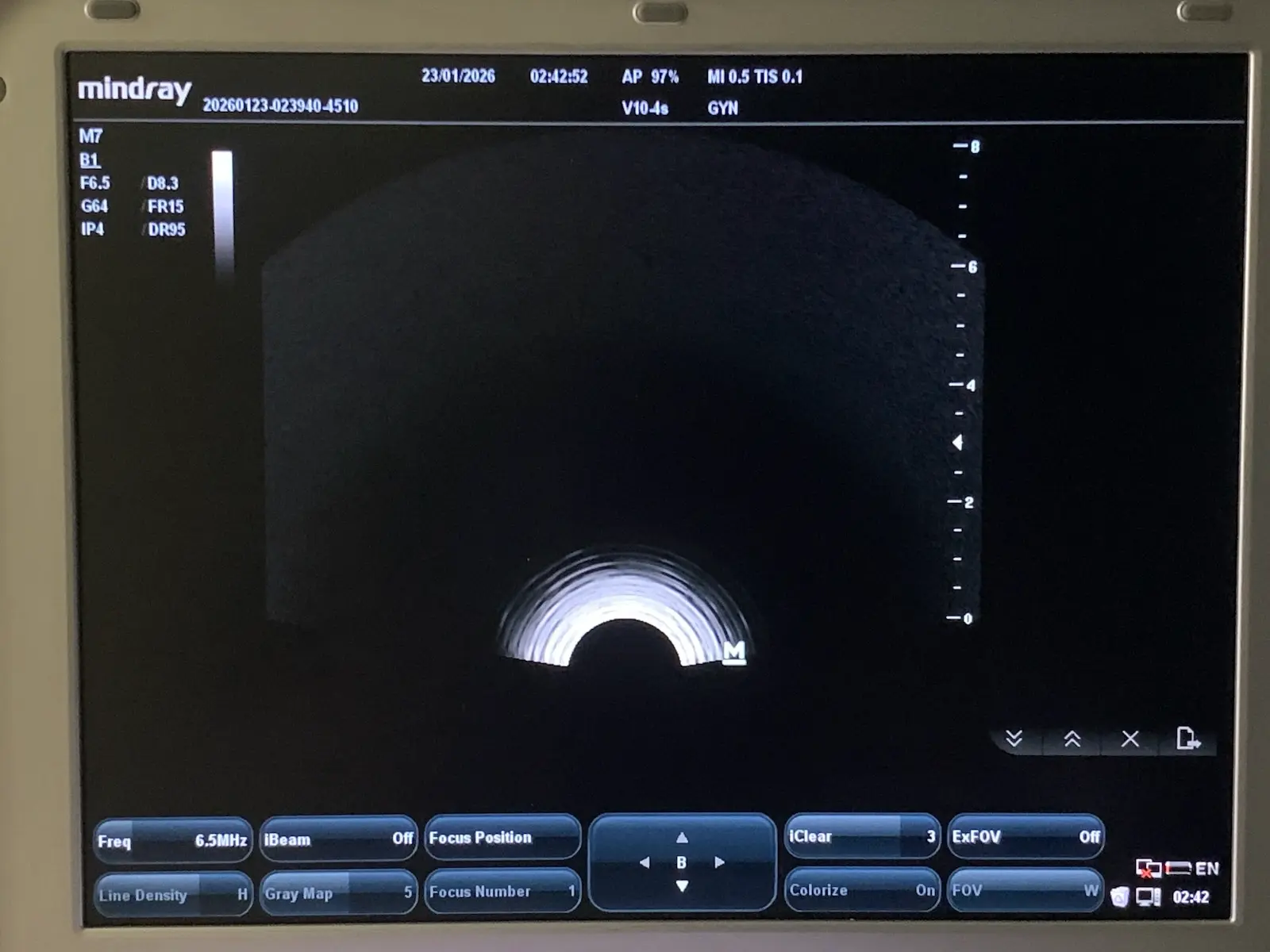 Mindray V10-4s Micro-Convex Endocavity Transducer Probe for M7 M6 Series