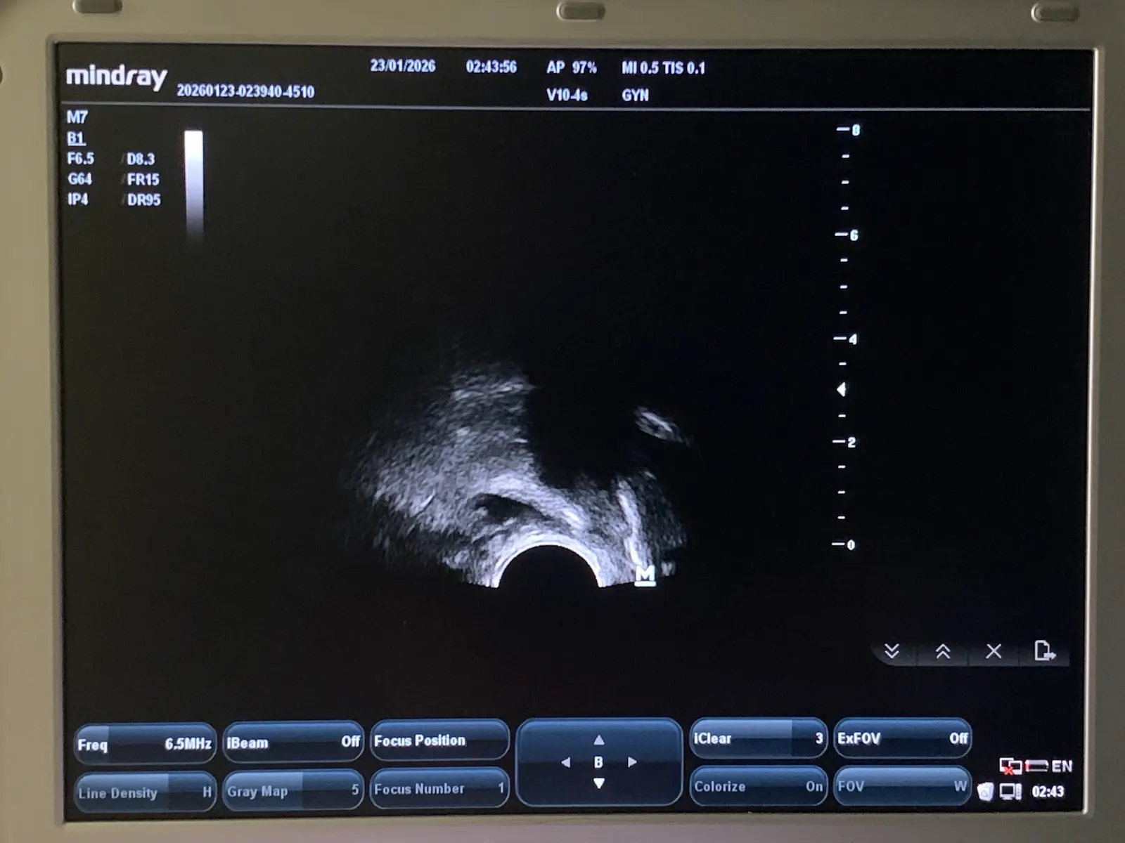 Mindray V10-4s Micro-Convex Endocavity Transducer Probe for M7 M6 Series