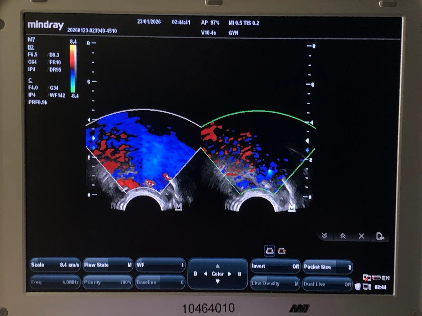 Mindray V10-4s Micro-Convex Endocavity Transducer Probe for M7 M6 Series