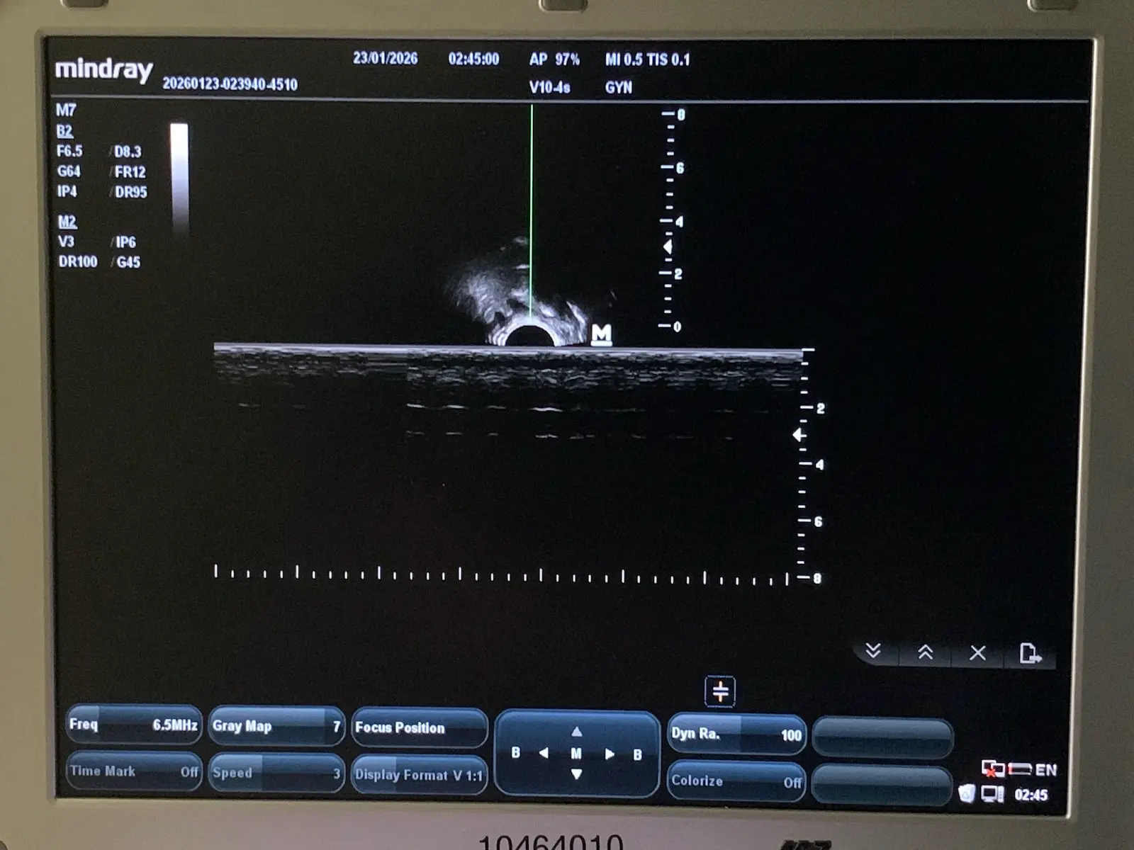 Mindray V10-4s Micro-Convex Endocavity Transducer Probe for M7 M6 Series