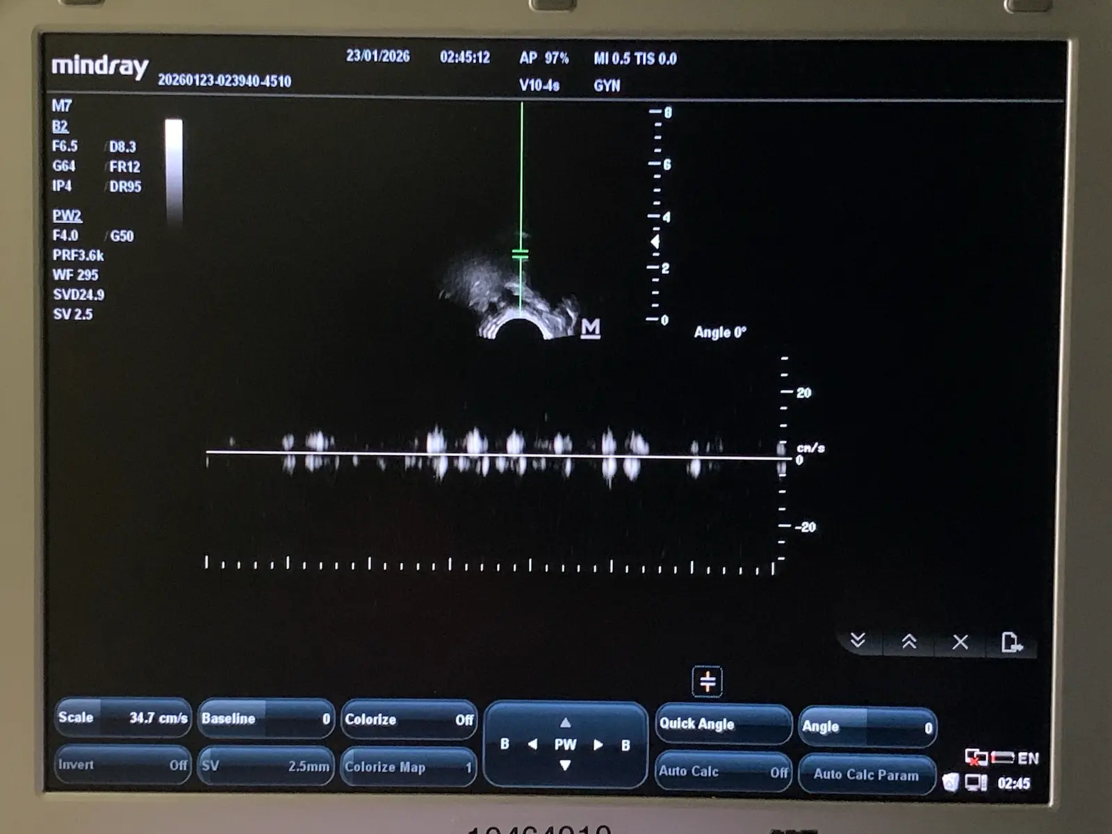 Mindray V10-4s Micro-Convex Endocavity Transducer Probe for M7 M6 Series